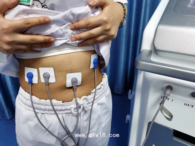 中頻胃腸治療儀 術(shù)后排氣綜合治療 胃腸動力恢復(fù)