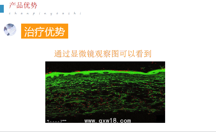  超聲電導透藥儀