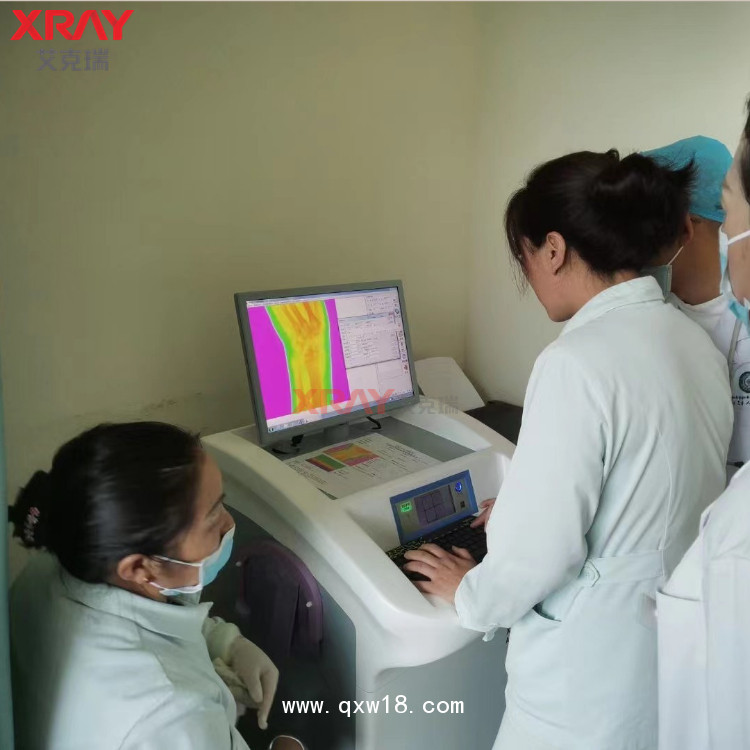 骨密度測(cè)試儀 艾克瑞Osteo檢測(cè)儀 用于成人骨質(zhì)檢測(cè)