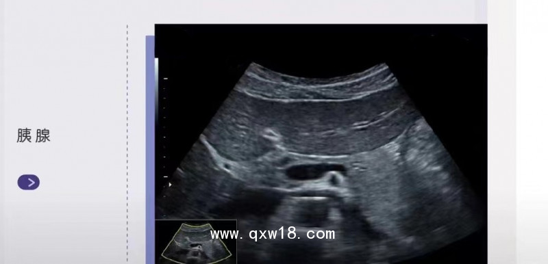 彩色超聲診斷儀