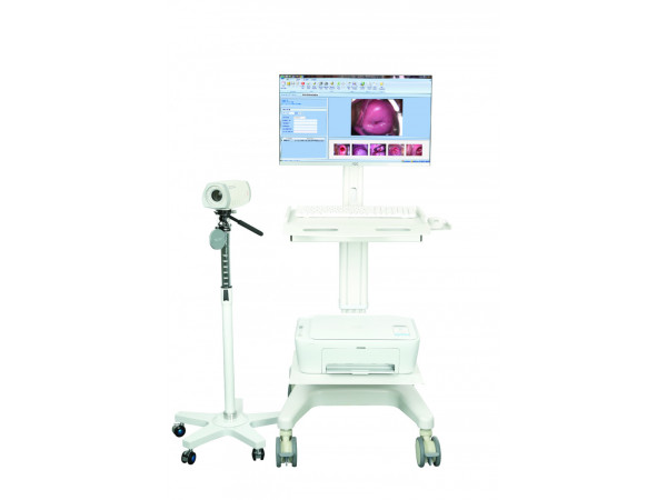 索吉瑞電子陰道鏡、電子陰道顯微鏡 SY02