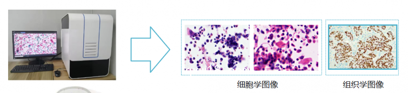 子宮內(nèi)膜癌篩查細胞醫(yī)學圖像分析系統(tǒng)