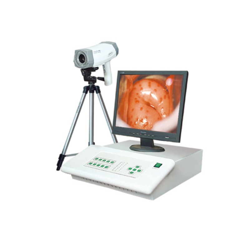 數(shù)碼電子陰道鏡 臺(tái)式陰道鏡BX-8100I、BX-8100II