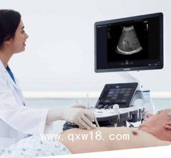 醫(yī)用超聲診斷儀HS40、XH40型號三星麥迪遜彩超