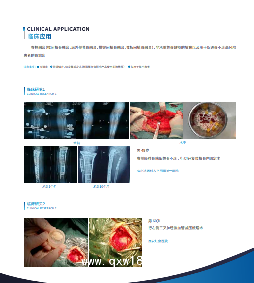 賦型脫鈣骨基質(zhì)材料