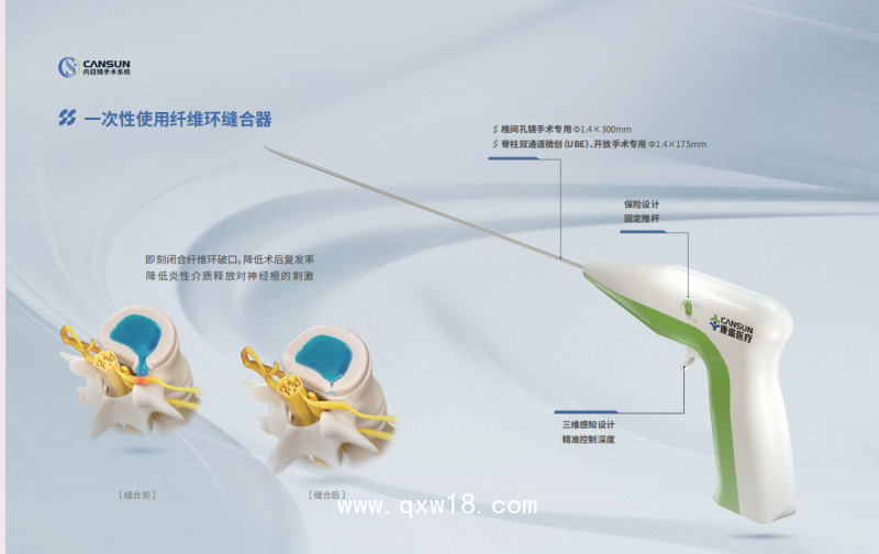 一次性使用纖維環(huán)縫合器