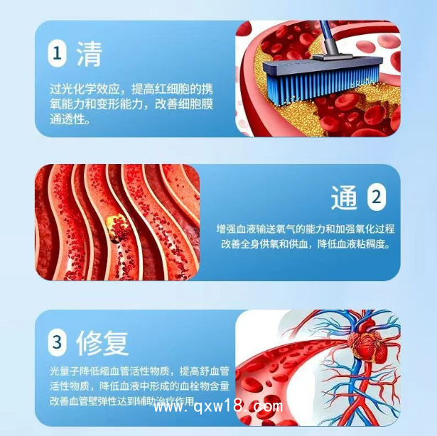 康企頸部半導(dǎo)體激光治療儀（暢享款）三高治療儀心血通心腦血管腦梗塞冠心病三高脂血高血壓