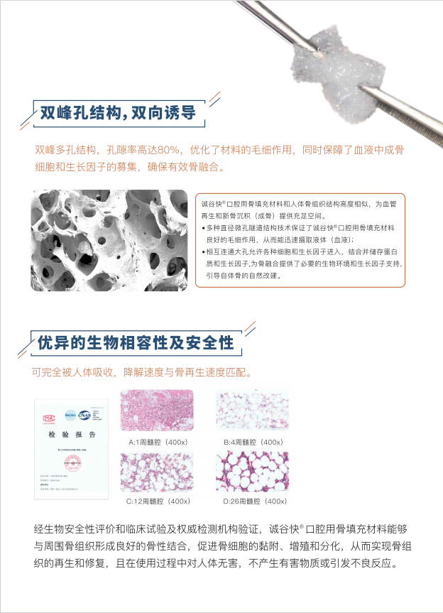 口腔用骨填充材料