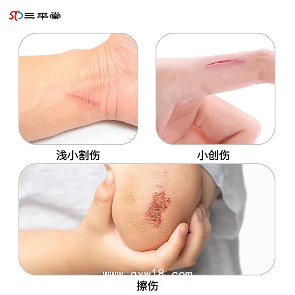 傷口清洗醫(yī)用液體敷料-傷口消毒殺菌-傷口消毒敷料促進愈合