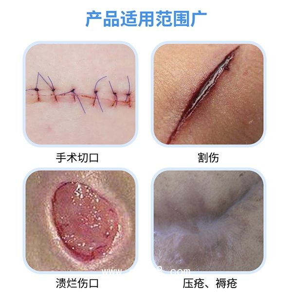 醫(yī)用無菌水膠體敷料