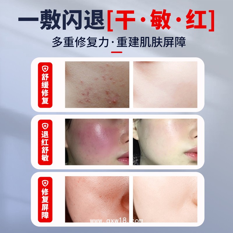 透明質(zhì)酸鈉敷料 二類械字號 美容院線專供