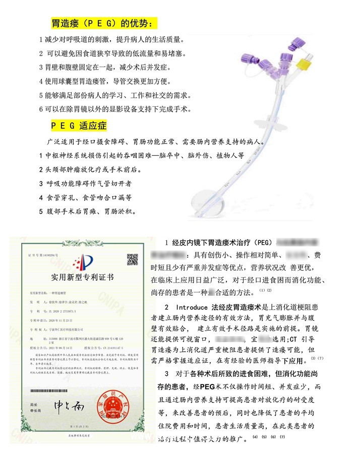 經(jīng)皮胃造瘺飼管（一次性使用胃造口營(yíng)養(yǎng)輸送裝置(PEG)）