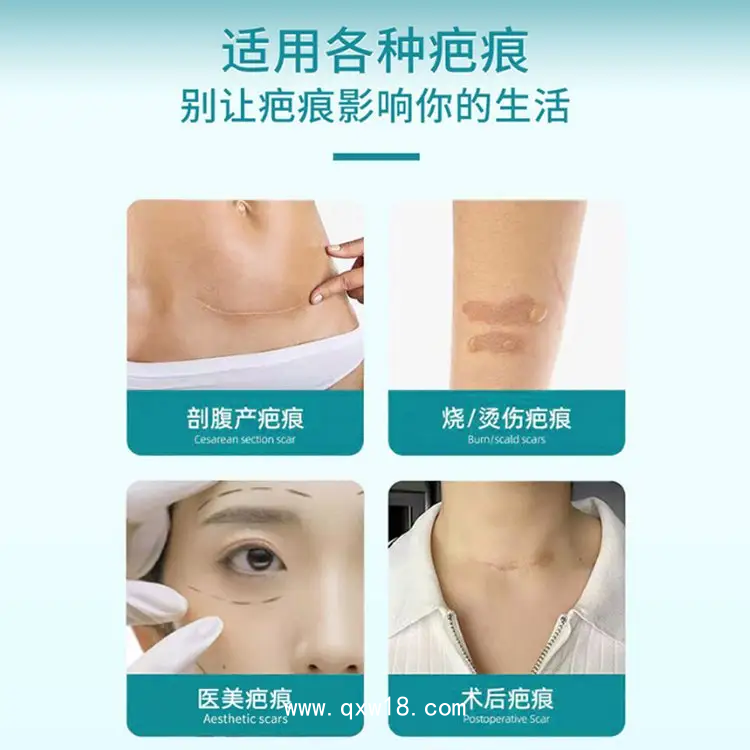 疤痕貼 巴痕痘疤燒傷疤修復(fù) 正規(guī)資質(zhì) 膚色透明均可加工定制廠