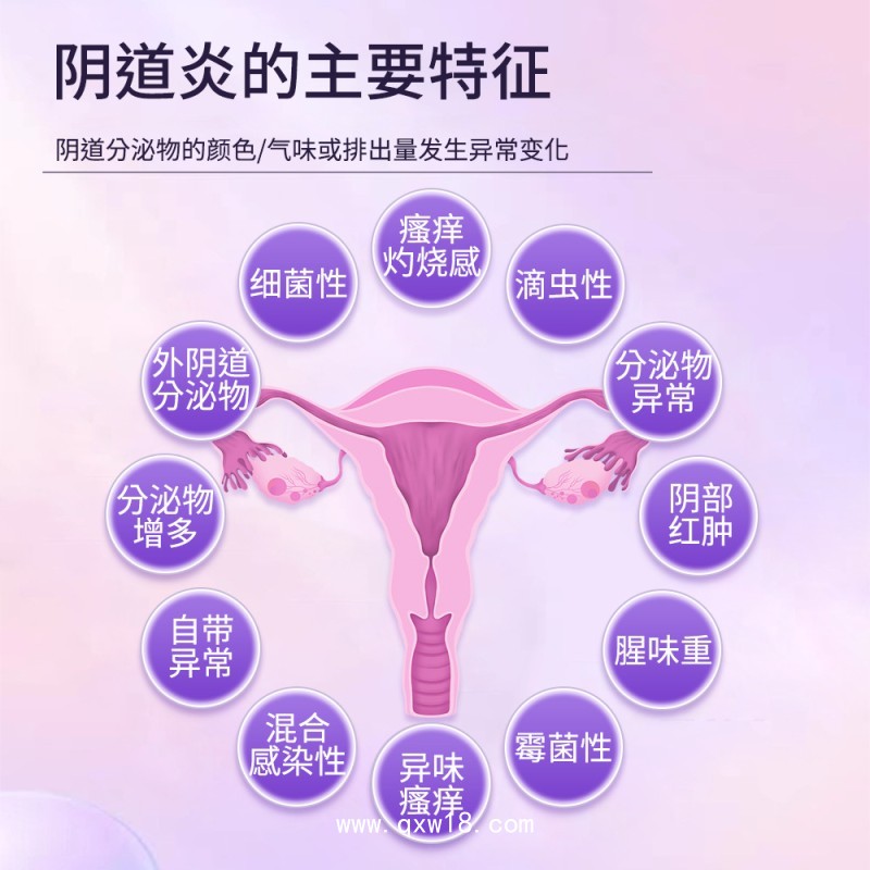 婦科凝膠女性私處護理抑菌適用于陰道炎代加工廠家