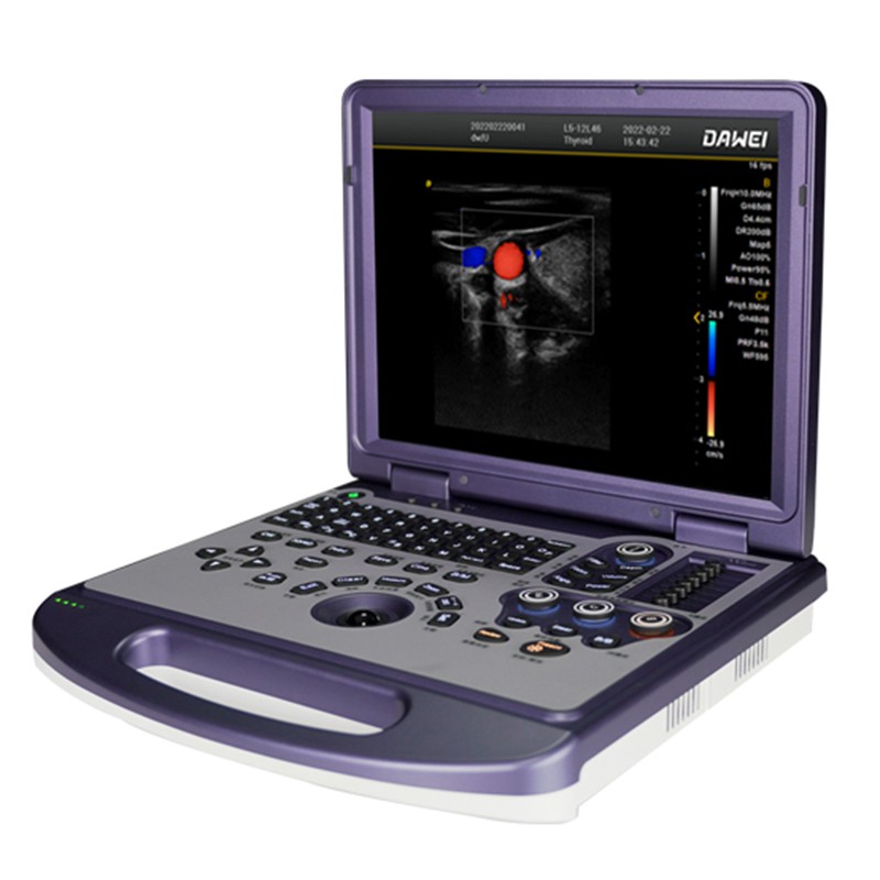 彩超機(jī)  便攜式彩超