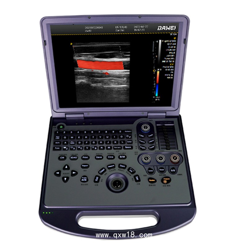 彩超機(jī)  便攜式彩超