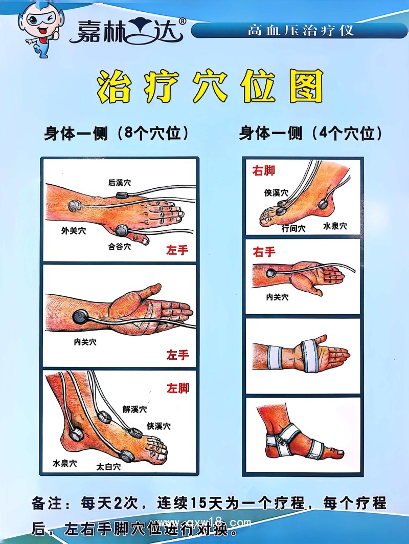家庭診所社區(qū)型號(hào)高血壓治療儀 適用原發(fā)性高血壓病患者輔助治療JL-12II