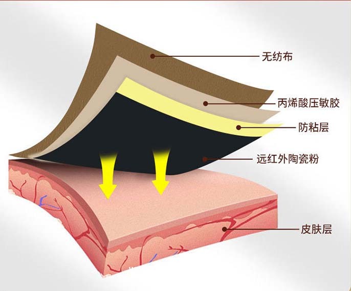 腰椎間盤突出貼 二類械字號可做臨床藥店等 支持招投標