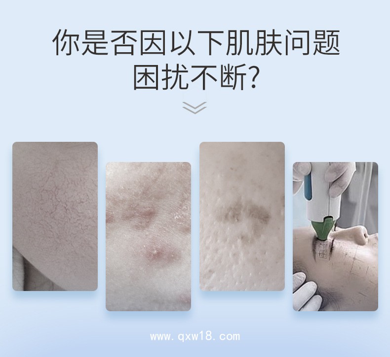 重組Ⅲ型人源化膠原蛋白敷料貼生產(chǎn)廠家 定制無(wú)菌械字號(hào)醫(yī)用冷敷貼