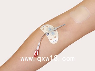 醫(yī)用導管體表固定裝置代加工