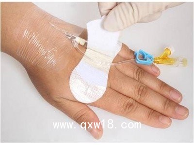 醫(yī)用導管體表固定裝置代加工