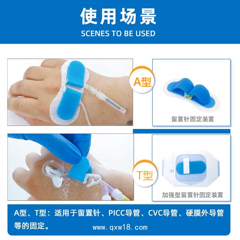 體表導管固定裝置廠家代加工