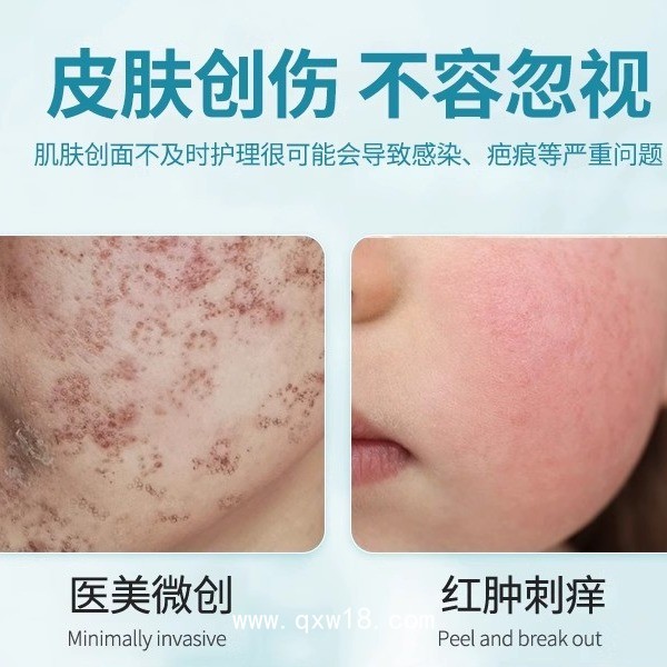 膠原貼敷料 三類械字號敷料定制代加工貼牌oem