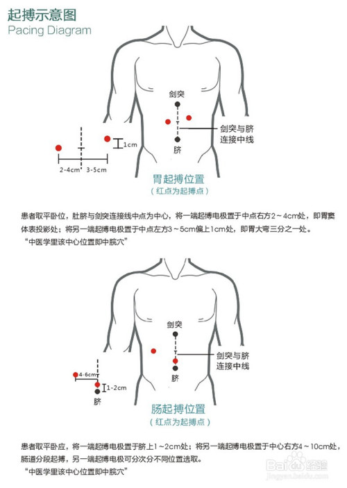 05a320a23a42a07ac9f75081673834bb18efc179 (1).jpg