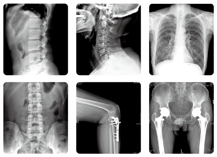 醫(yī)用X光機(jī)