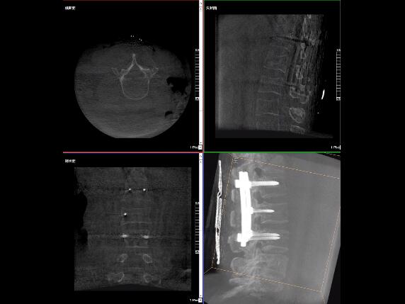【醫(yī)療科普】2分鐘帶你了解高質(zhì)量X光片的標(biāo)準(zhǔn)是什么？