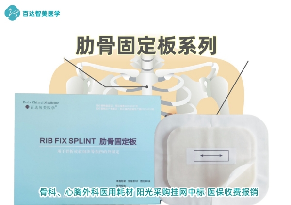 肋骨固定板-武漢百達(dá)智美醫(yī)學(xué)