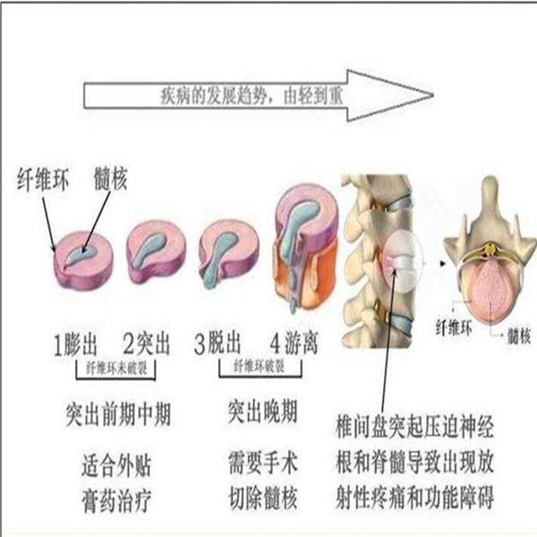 1686126518280450.png 14fa57d2d22674eee5bf9ca073ddbe9.png