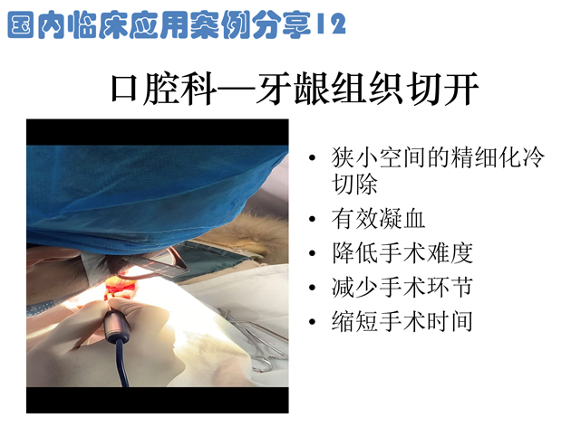 低溫射頻刀牙齦組織切開(kāi)