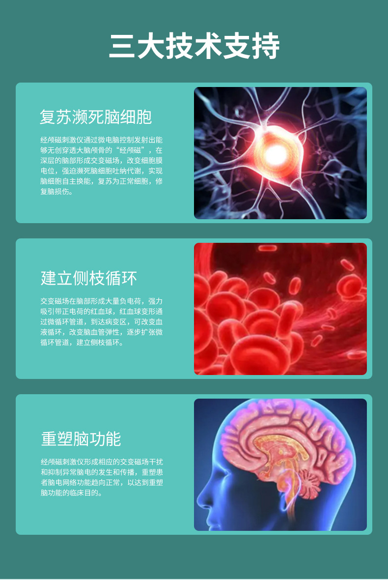 經(jīng)顱磁電療儀.jpg